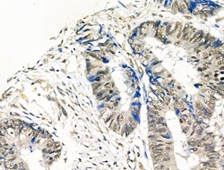 Invitrogen Phospho-CTDSPL2 (Ser104) Polyclonal Antibody 100 &mu;L; Unconjugated:Antibodies,