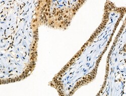 Invitrogen Phospho-CTDSPL2 (Ser104) Polyclonal Antibody 100 &mu;L; Unconjugated:Antibodies,
