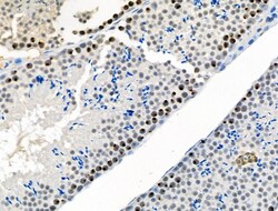 Invitrogen Phospho-CTDSPL2 (Ser104) Polyclonal Antibody 100 &mu;L; Unconjugated:Antibodies,
