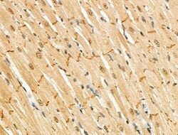 Invitrogen Phospho-CTDSPL2 (Ser104) Polyclonal Antibody 100 &mu;L; Unconjugated:Antibodies,