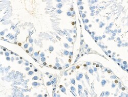 Invitrogen Phospho-CTDSPL2 (Ser104) Polyclonal Antibody 100 &mu;L; Unconjugated:Antibodies,