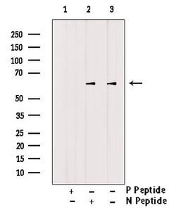 Invitrogen Phospho-CTDSPL2 (Ser104) Polyclonal Antibody 100 &mu;L; Unconjugated:Antibodies,