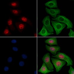Invitrogen Phospho-Cyclin E (Thr77) Polyclonal Antibody 100 &mu;L; Unconjugated:Antibodies,