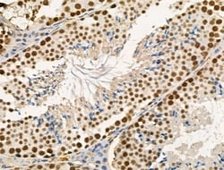 Invitrogen Phospho-DAB1 (Tyr220) Polyclonal Antibody 100 &mu;L | Buy Online | Invitrogen&trade; | Fisher Scientific