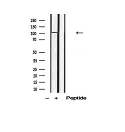 Invitrogen Phospho-DAB1 (Tyr220) Polyclonal Antibody 100 &mu;L | Buy Online | Invitrogen&trade; | Fisher Scientific
