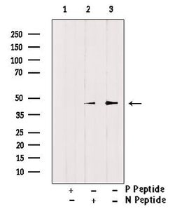 Invitrogen Phospho-Doublecortin (Ser297) Polyclonal Antibody 100 &mu;L | Buy Online | Invitrogen&trade; | Fisher Scientific