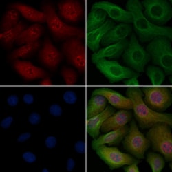 Invitrogen Phospho-EEF2K (Ser366) Polyclonal Antibody 100 &mu;L | Buy Online | Invitrogen&trade; | Fisher Scientific