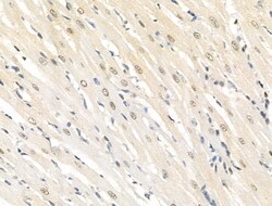 Invitrogen Phospho-EEF2K (Ser366) Polyclonal Antibody 100 &mu;L | Buy Online | Invitrogen&trade; | Fisher Scientific
