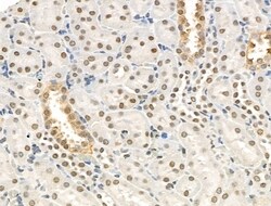 Invitrogen Phospho-EEF2K (Ser366) Polyclonal Antibody 100 &mu;L | Buy Online | Invitrogen&trade; | Fisher Scientific