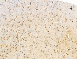 Invitrogen Phospho-EEF2K (Ser366) Polyclonal Antibody 100 &mu;L | Buy Online | Invitrogen&trade; | Fisher Scientific