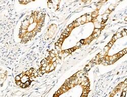 Invitrogen Phospho-FOXO3A (Ser413) Polyclonal Antibody 100 &mu;L; Unconjugated:Antibodies