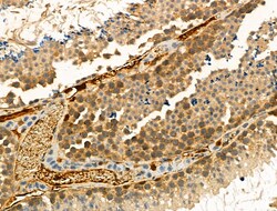 Invitrogen Phospho-FOXO3A (Ser413) Polyclonal Antibody 100 &mu;L; Unconjugated:Antibodies