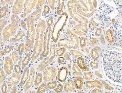 Invitrogen Phospho-GRB10 (Ser476) Polyclonal Antibody 100 &mu;L; Unconjugated:Antibodies,