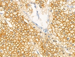 Invitrogen Phospho-GRB10 (Ser476) Polyclonal Antibody 100 &mu;L; Unconjugated:Antibodies,