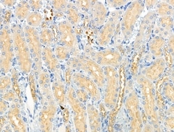 Invitrogen Phospho-GRB10 (Ser476) Polyclonal Antibody 100 &mu;L; Unconjugated:Antibodies,