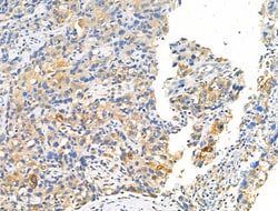 Invitrogen Phospho-ErbB2 (HER-2) (Tyr1196) Polyclonal Antibody 100 &mu;L;