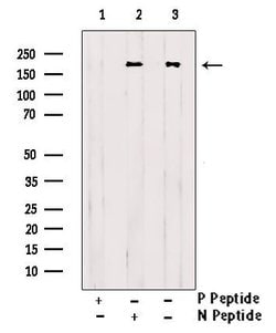 Invitrogen Phospho-ErbB2 (HER-2) (Tyr1196) Polyclonal Antibody 100 &mu;L;