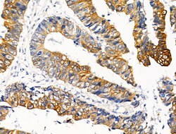 Phospho-Cytokeratin 20 (Ser13) Polyclonal Antibody, Invitrogen 100 &mu;L;