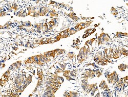 Phospho-Cytokeratin 20 (Ser13) Polyclonal Antibody, Invitrogen 100 &mu;L;