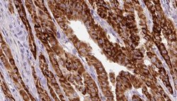 Phospho-Cytokeratin 20 (Ser13) Polyclonal Antibody, Invitrogen 100 &mu;L;