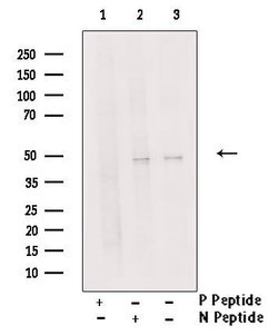 Phospho-Cytokeratin 20 (Ser13) Polyclonal Antibody, Invitrogen 100 &mu;L;