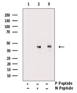 Invitrogen Phospho-LAT (Tyr200) Polyclonal Antibody 100 &mu;L; Unconjugated:Antibodies,