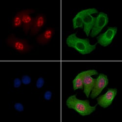 Invitrogen Phospho-MAPKAPK2 (Thr222) Polyclonal Antibody 100 &mu;L; Unconjugated:Antibodies,