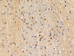 Invitrogen Phospho-MEF2A (Ser408) Polyclonal Antibody 100 &mu;L | Buy Online | Invitrogen&trade; | Fisher Scientific