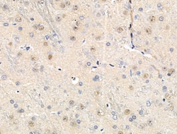 Invitrogen Phospho-MEF2A (Ser408) Polyclonal Antibody 100 &mu;L | Buy Online | Invitrogen&trade; | Fisher Scientific