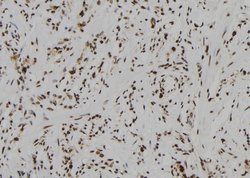 Invitrogen Phospho-MEF2A (Ser408) Polyclonal Antibody 100 &mu;L | Buy Online | Invitrogen&trade; | Fisher Scientific