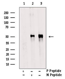 Invitrogen Phospho-MEF2A (Ser408) Polyclonal Antibody 100 &mu;L | Buy Online | Invitrogen&trade; | Fisher Scientific