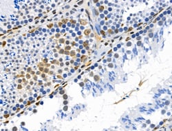 Invitrogen Phospho-MEK1 (Thr286) Polyclonal Antibody 100 &mu;L | Buy Online | Invitrogen&trade; | Fisher Scientific