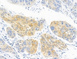 Invitrogen Phospho-C2orf33 (Ser172, Ser146) Polyclonal Antibody 100 &mu;L;