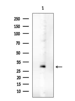 Invitrogen Phospho-C2orf33 (Ser172, Ser146) Polyclonal Antibody 100 &mu;L;