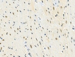 Invitrogen Phospho-NuMA (Ser395) Polyclonal Antibody 100 &mu;L | Buy Online | Invitrogen&trade; | Fisher Scientific