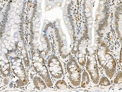 Invitrogen Phospho-NuMA (Ser395) Polyclonal Antibody 100 &mu;L | Buy Online | Invitrogen&trade; | Fisher Scientific