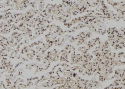 Invitrogen Phospho-NuMA (Ser395) Polyclonal Antibody 100 &mu;L | Buy Online | Invitrogen&trade; | Fisher Scientific