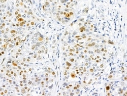 Invitrogen Phospho-NuMA (Thr2055) Polyclonal Antibody 100 &mu;L; Unconjugated:Antibodies,