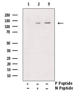 Invitrogen Phospho-p130Cas (Tyr249) Polyclonal Antibody 100 &mu;L; Unconjugated:Antibodies,