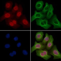 Invitrogen Phospho-p53 (Thr81) Polyclonal Antibody 100 &mu;L; Unconjugated:Antibodies,