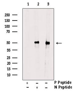 Invitrogen Phospho-p53 (Thr81) Polyclonal Antibody 100 &mu;L; Unconjugated:Antibodies,