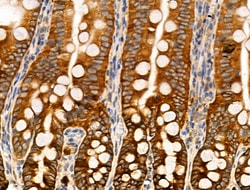 Invitrogen Phospho-PLCB3 (Ser1105) Polyclonal Antibody 100 &mu;L; Unconjugated:Antibodies,
