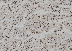 Invitrogen Phospho-Rb (Ser608) Polyclonal Antibody 100 &mu;L; Unconjugated:Antibodies,