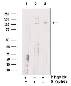 Invitrogen Phospho-Rb (Ser608) Polyclonal Antibody 100 &mu;L; Unconjugated:Antibodies,