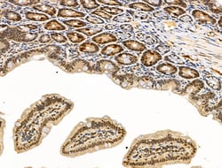 Invitrogen Phospho-Rb (Ser608) Polyclonal Antibody 100 &mu;L; Unconjugated:Antibodies,