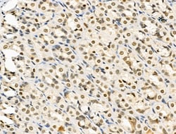 Invitrogen Phospho-Rb (Ser608) Polyclonal Antibody 100 &mu;L; Unconjugated:Antibodies,