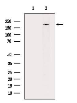 Invitrogen Phospho-RICTOR (Thr1135) Polyclonal Antibody 100 &mu;L; Unconjugated:Antibodies,