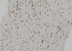 Invitrogen Phospho-RSK2 (Ser227) Polyclonal Antibody 100 &mu;L; Unconjugated:Antibodies,