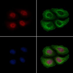 Invitrogen Phospho-RSK2 (Ser227) Polyclonal Antibody 100 &mu;L; Unconjugated:Antibodies,