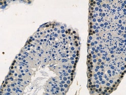 Invitrogen Phospho-RSK2 (Ser227) Polyclonal Antibody 100 &mu;L; Unconjugated:Antibodies,